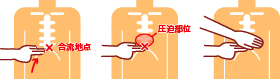 圧迫部位の決定